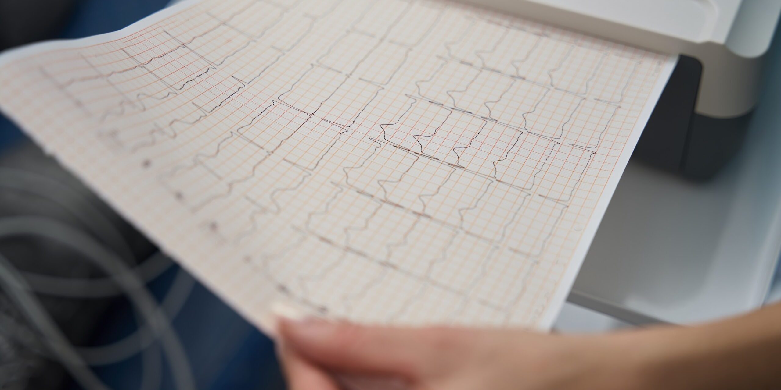 elettrocardiogramma come si legge