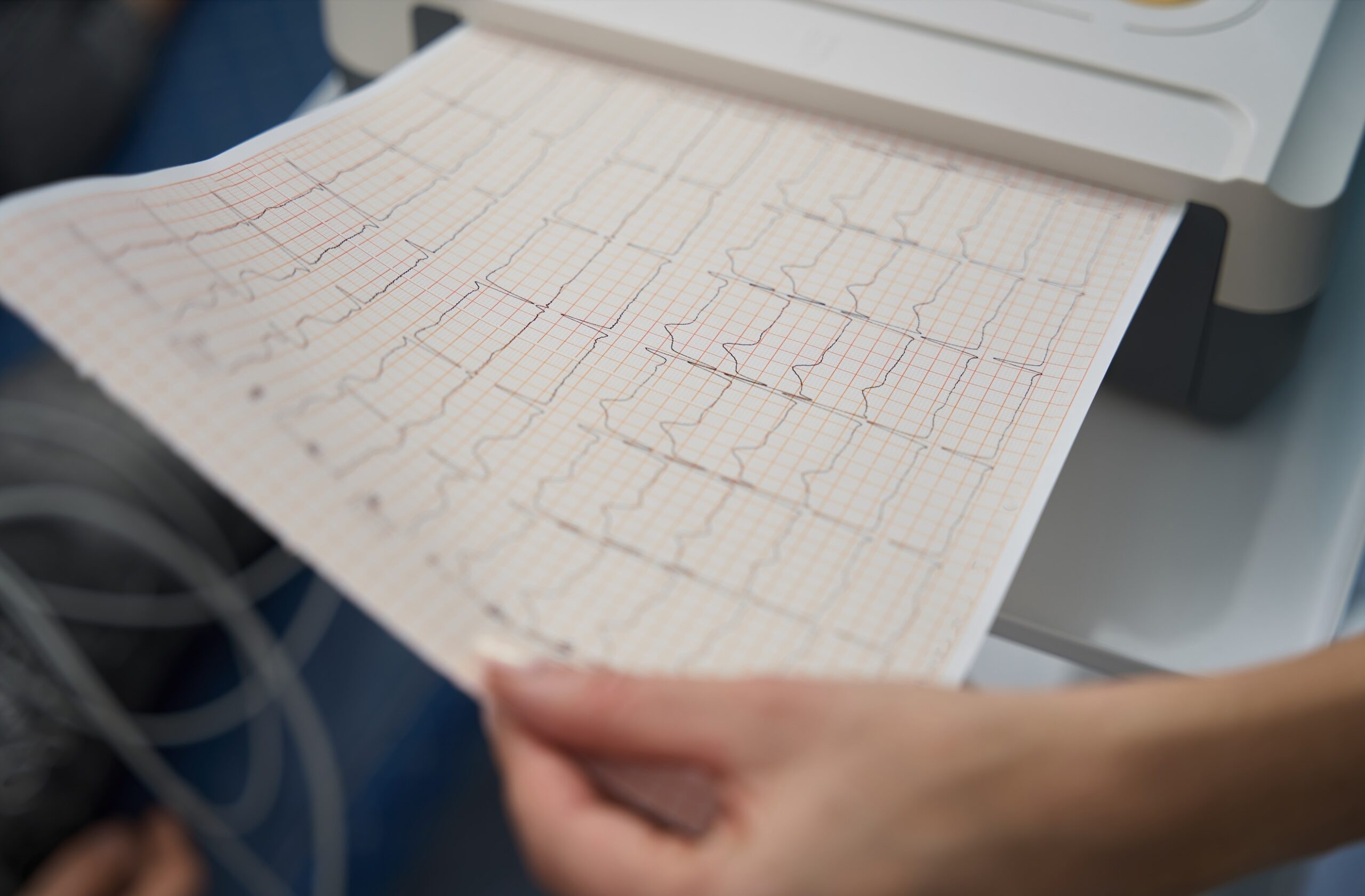 Screenshot elettrocardiogramma come si legge